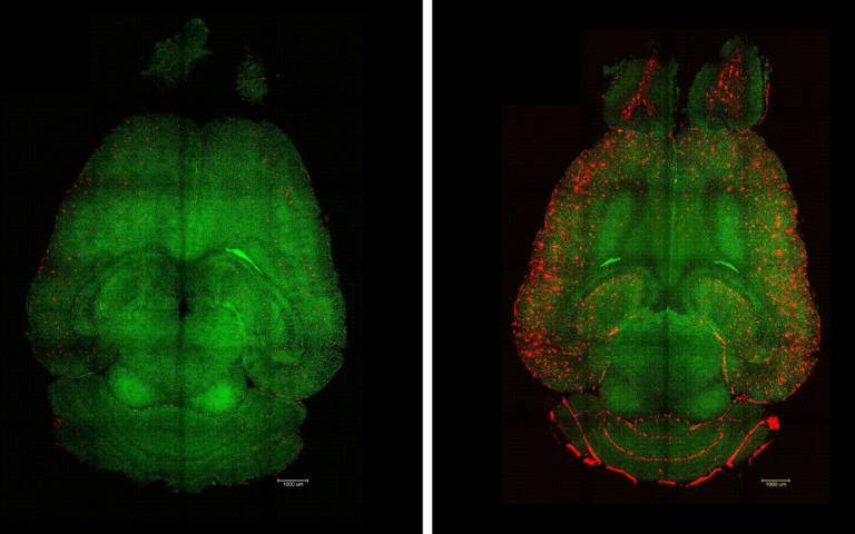 Nanotecnologia consegue reverter Alzheimer em camundongos e abre uma nova fronteira para a medicina mundial